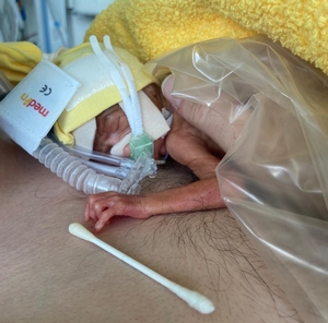 Foto aus dem Erfahrungsbericht «SSW 23+5» (Bild 2)