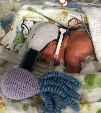 Foto aus dem Erfahrungsbericht «SSW 27+4» (Bild 1)